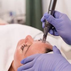 cameo college|cameo college microdermabrasion.